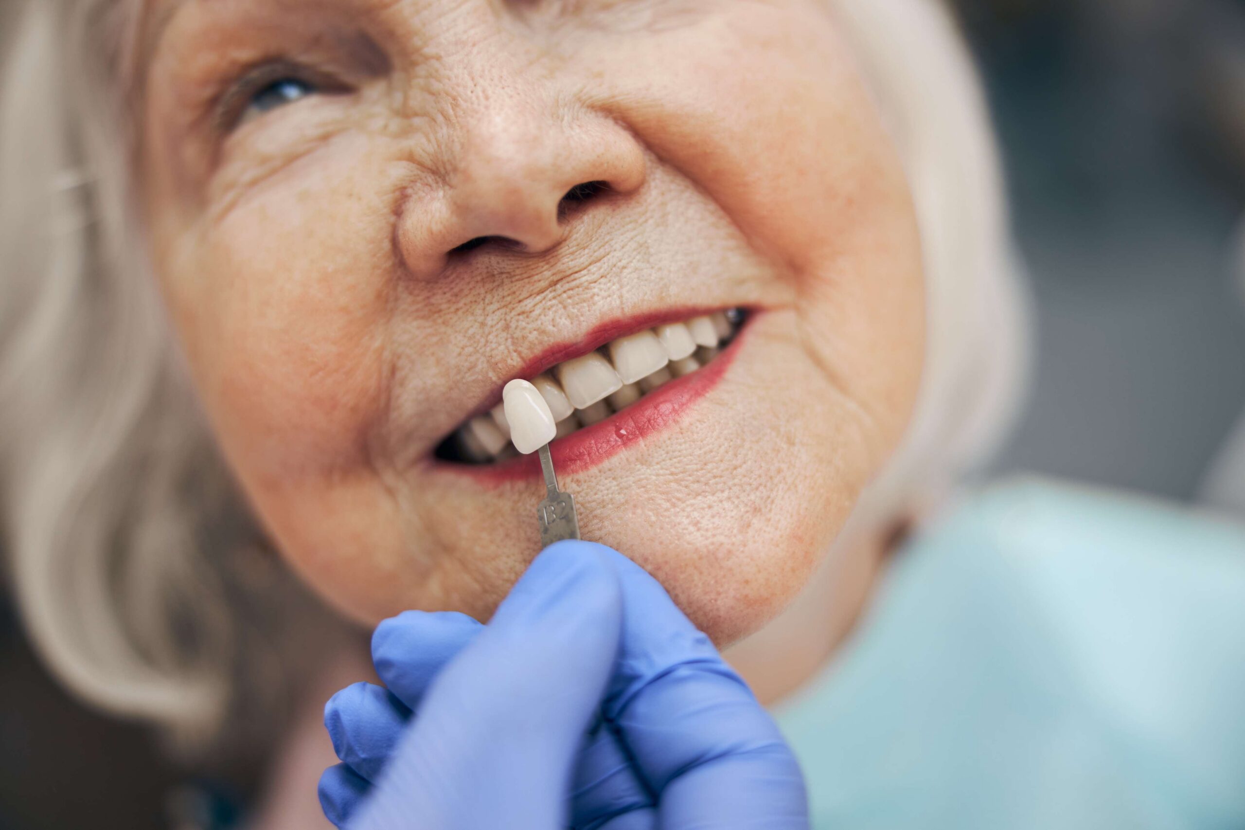 Featured image for “Invisalign Everett MA for Straighter Teeth”